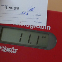 gebrauchtes Photometer f. Hemoglobin Mallinckrodt Medical Gmbh HemoCue B-Hemoglobin